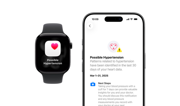 Lehetséges hipertóniával kapcsolatos értesítés egy Apple Watch Series 11-en, részletes értesítés egy iPhone-on